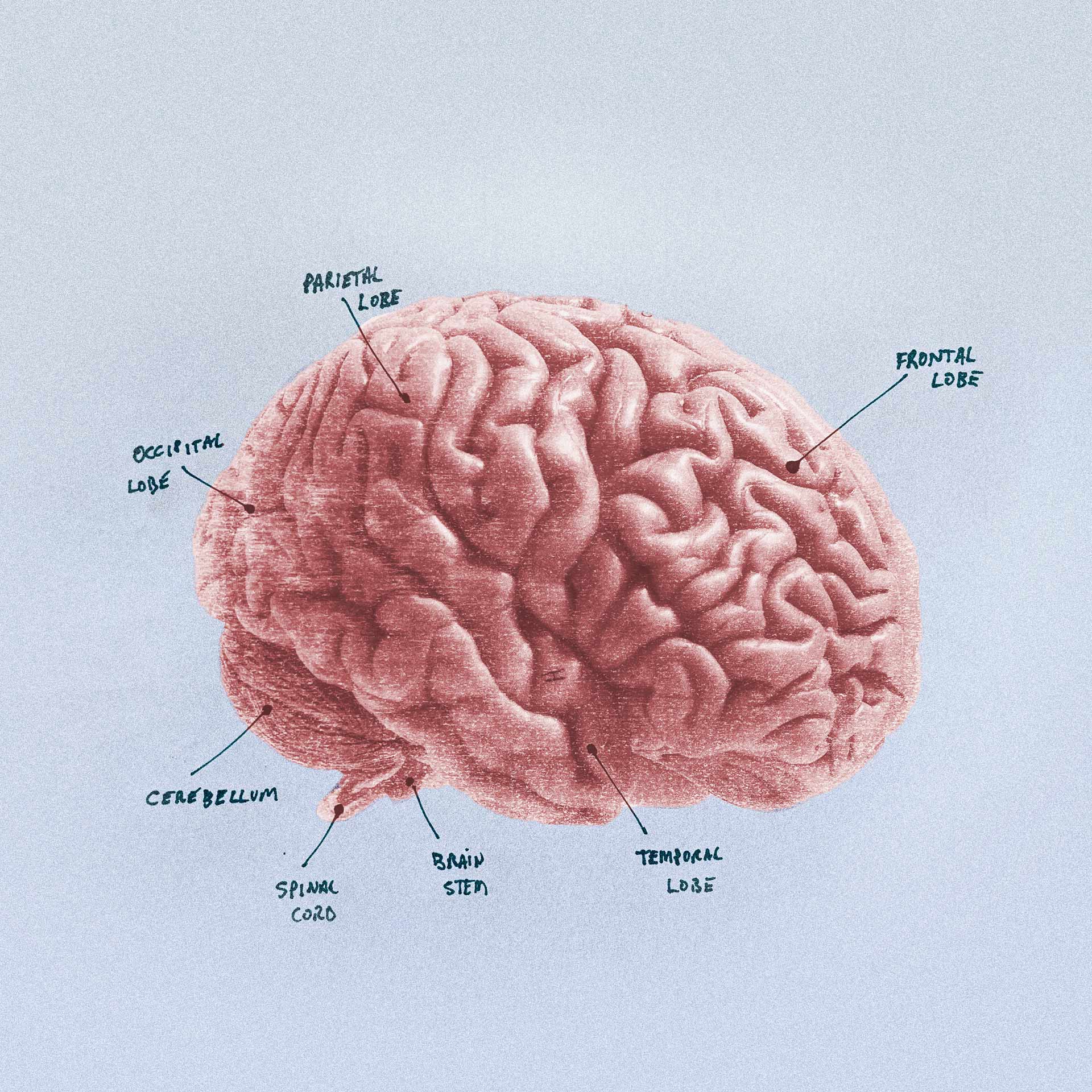 Annotated brain image