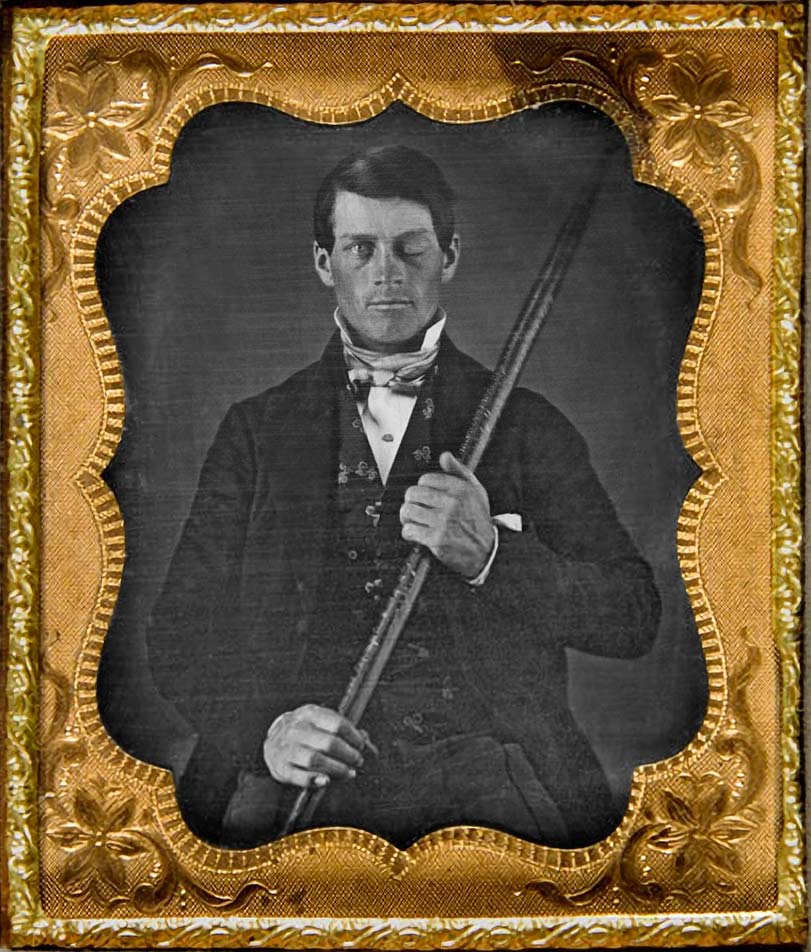 Daguerreotype photo of Phineas Gage after his accident